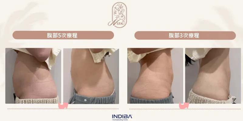 台中英特波課程推薦N SPA,透過真實案例帶你了解課程優勢 台中N SPA英特波課程案例-台中體雕推薦N SPA