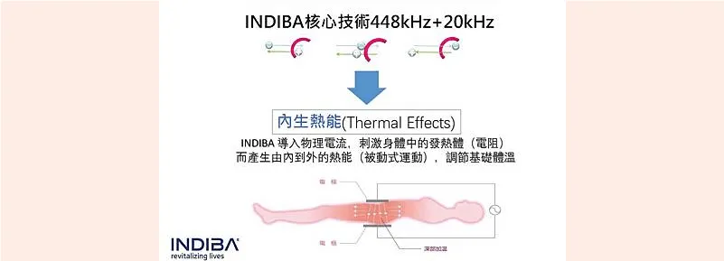 INDIBA英特波會內生熱作用,有如被動式的運動 台中體雕英特波推薦-台中SPA推薦