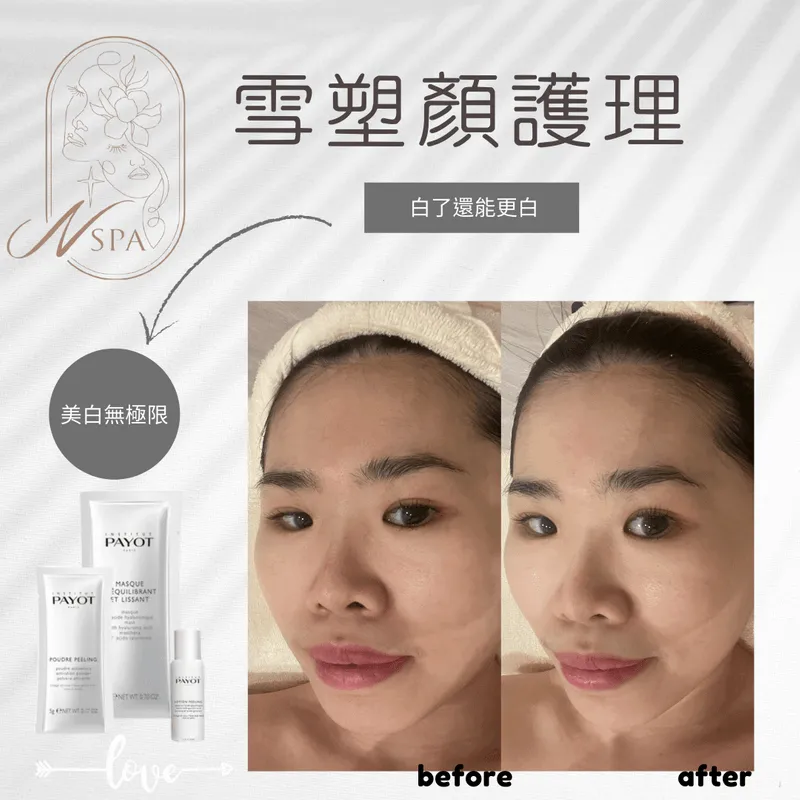 無美肌、無修圖、原相機,一次療程就有感 NSPA夏日雪白-台中美容SPA推薦
